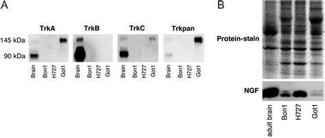 Tropomyosin receptor kinase: a novel target in screened 